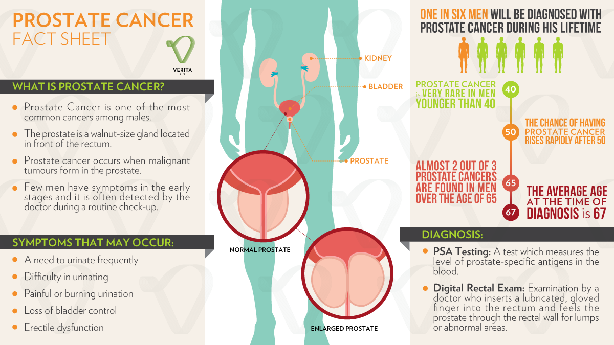 Talking To Your Doctor About Early Stage Prostate Cancer