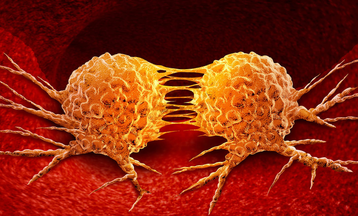 Mathematical Model explains onset of Metastasis - Verita Life